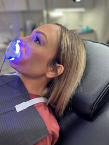 How Yellowing Teeth Can Make You Look a Decade Older and How Whitening Helps